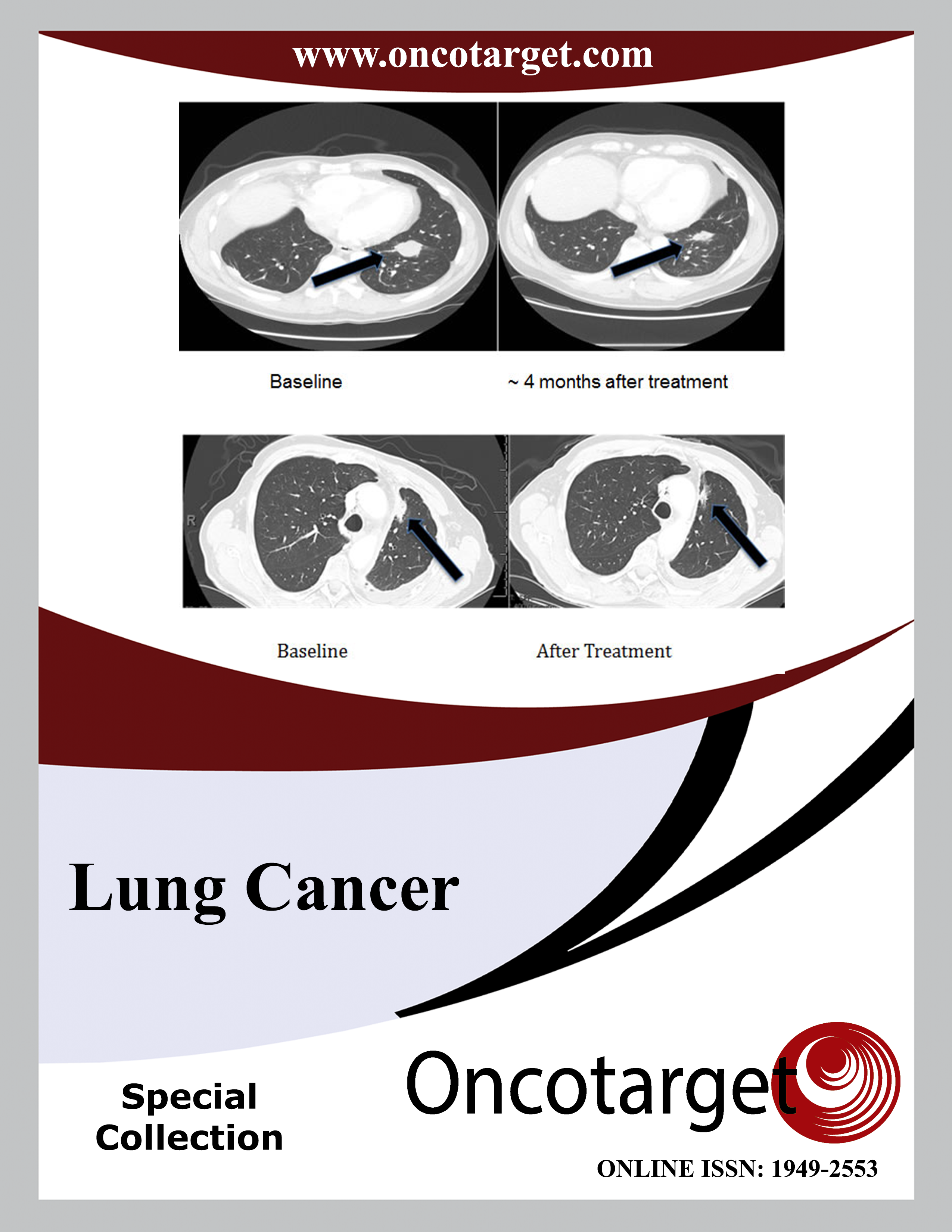 Lung Cancer, Recent research and Discoveries