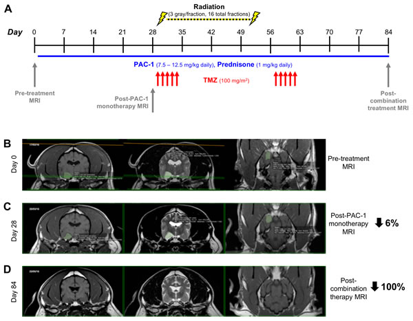Figure 5: Evaluation of combining oral PAC-1 with TMZ and definitive ionizing radiation therapy in pet dogs with non-resectable gliomas A. Schematic of treatment schedule