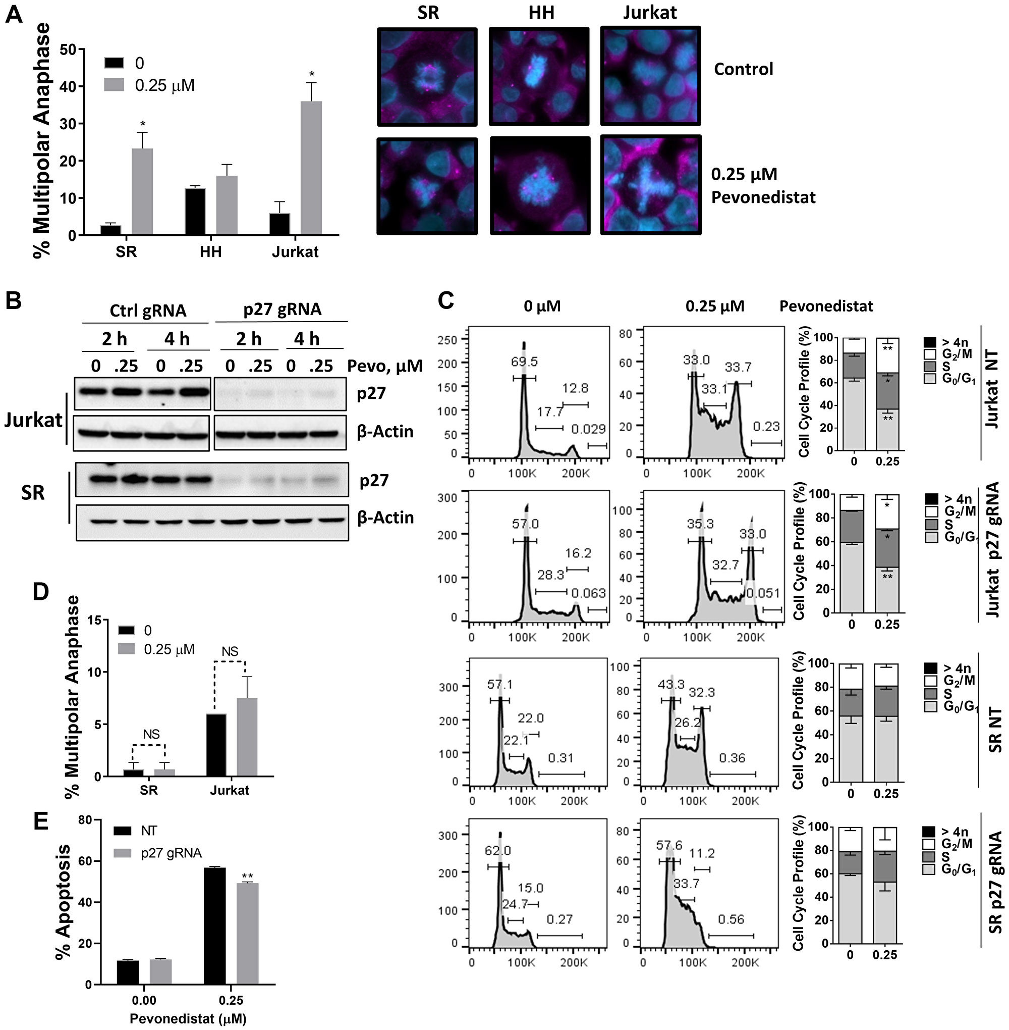 Figure 4: Malignant T-cells undergo anaphase catastrophe following NAE inhibition.
