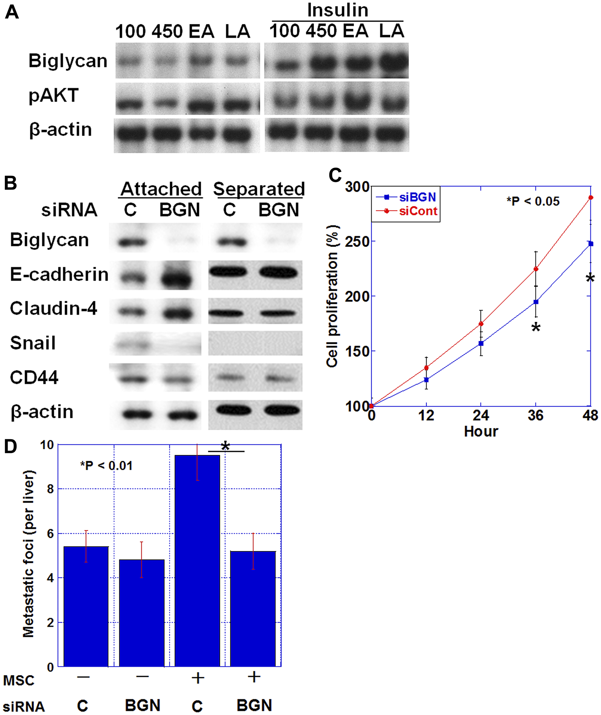 Figure 4: Biglycan expression and epithelial-mesenchymal transition (EMT).