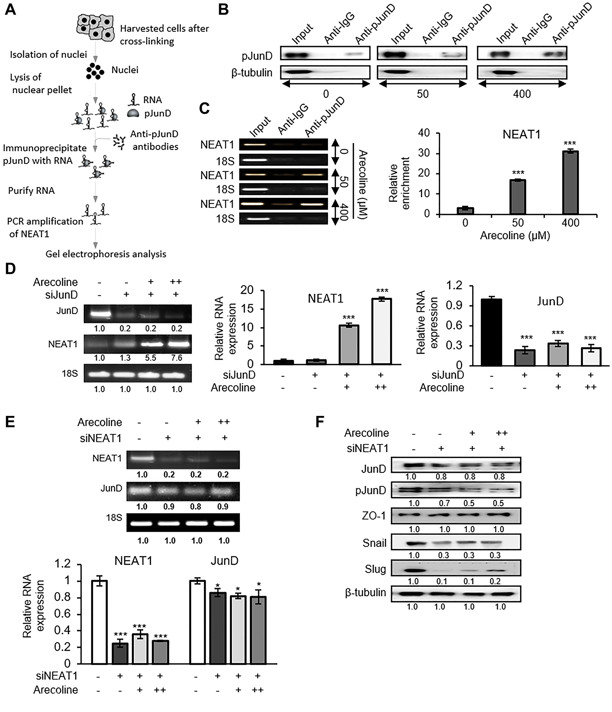 Figure 8: NEAT1 plays a pivotal role in JunD-mediated downregulation of ZO-1.