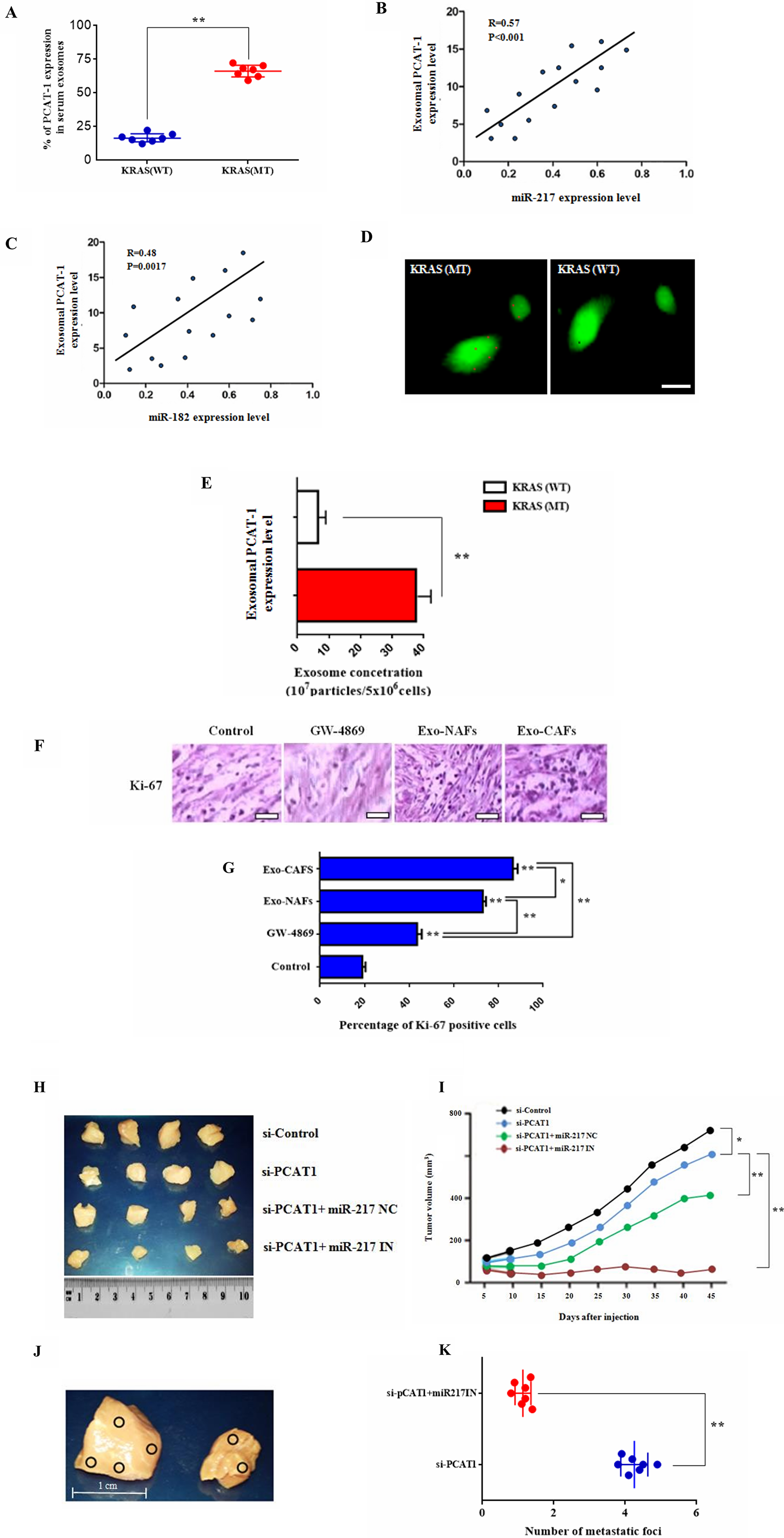 Figure 6: Exosomal PCAT-1 promotes tumor growth and guides lymph node metastasis  in vivo