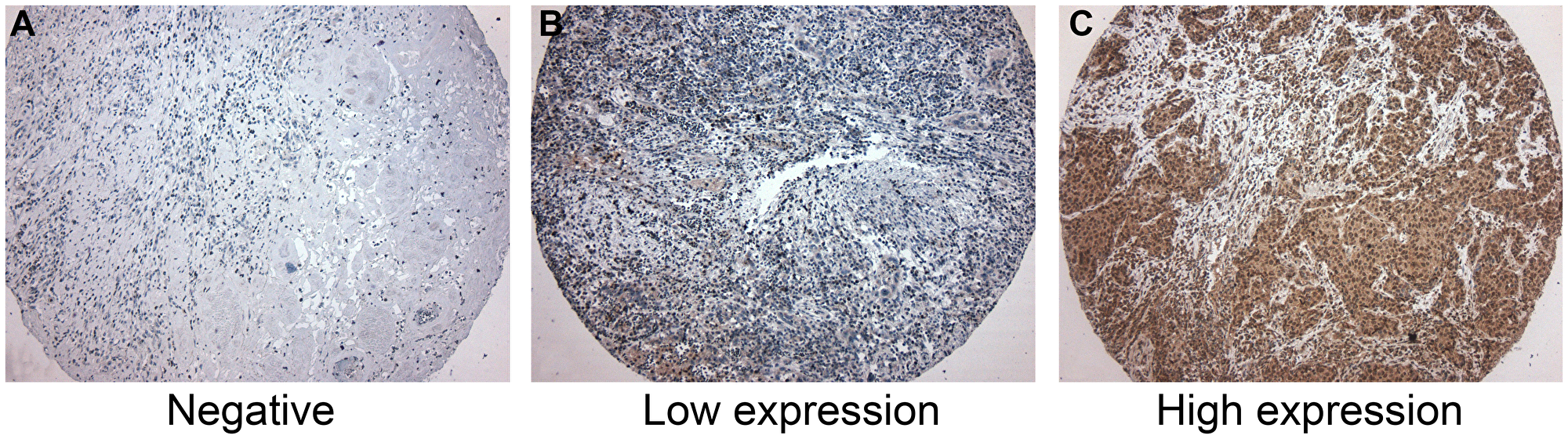 Figure 1: Immunohistochemistry for CD39.