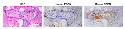 Figure 10: PDPN expression in human OSCC cells and infiltrating mouse fibroblasts in xenograft tumors.