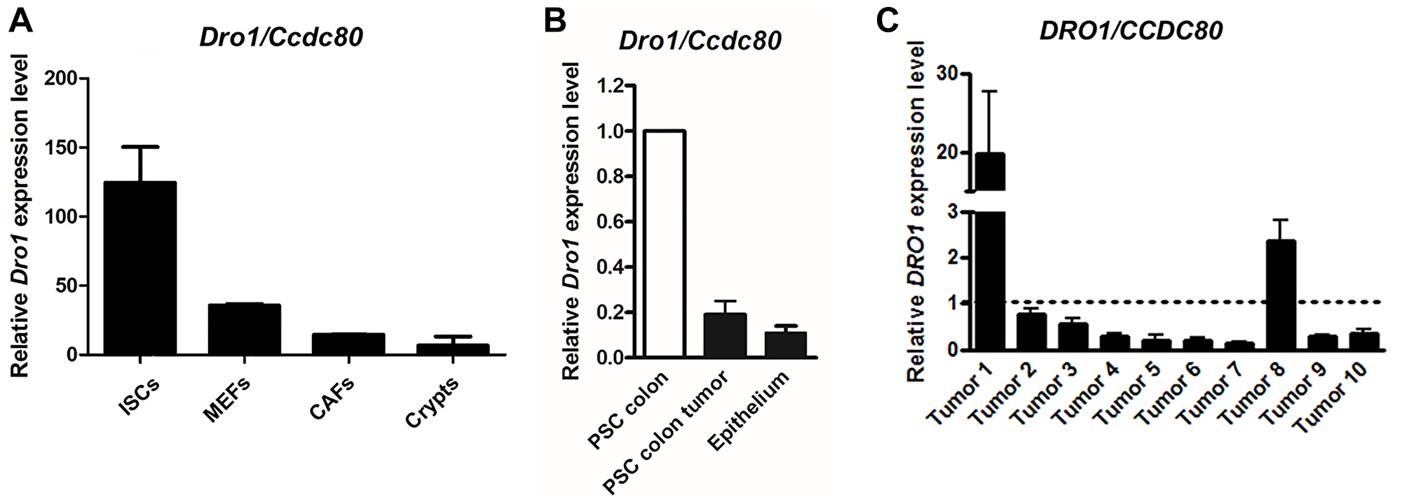 Figure 4: DRO1/CCDC80 is down-regulated in the stromal tumor compartment.