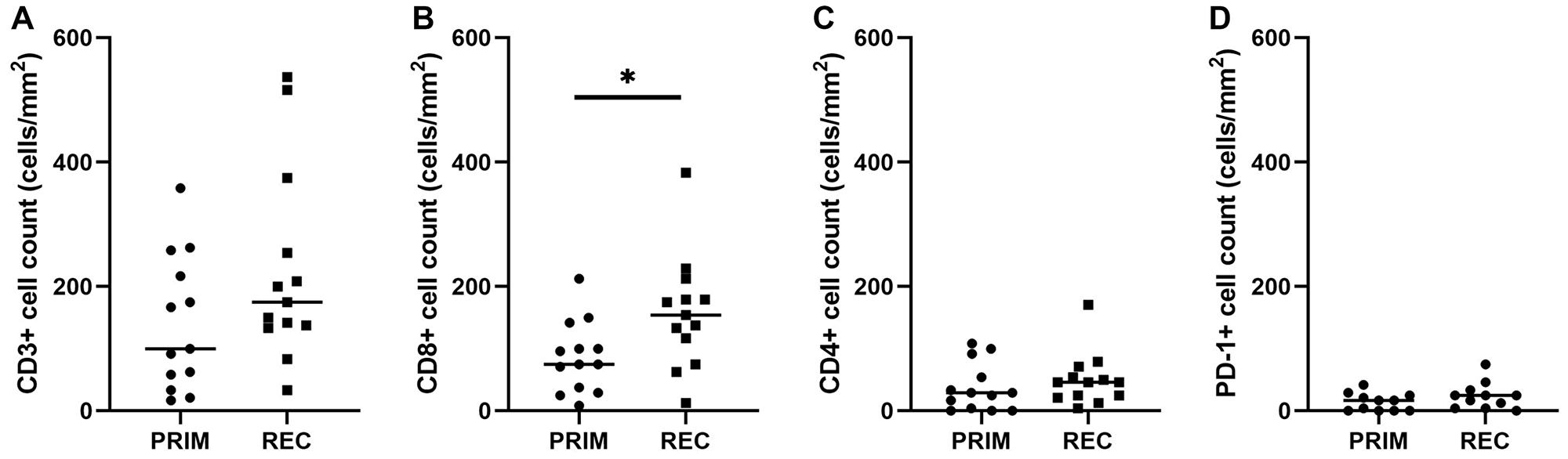 Figure 3: Quantitative TIL scores in primary and recurrent glioblastoma.