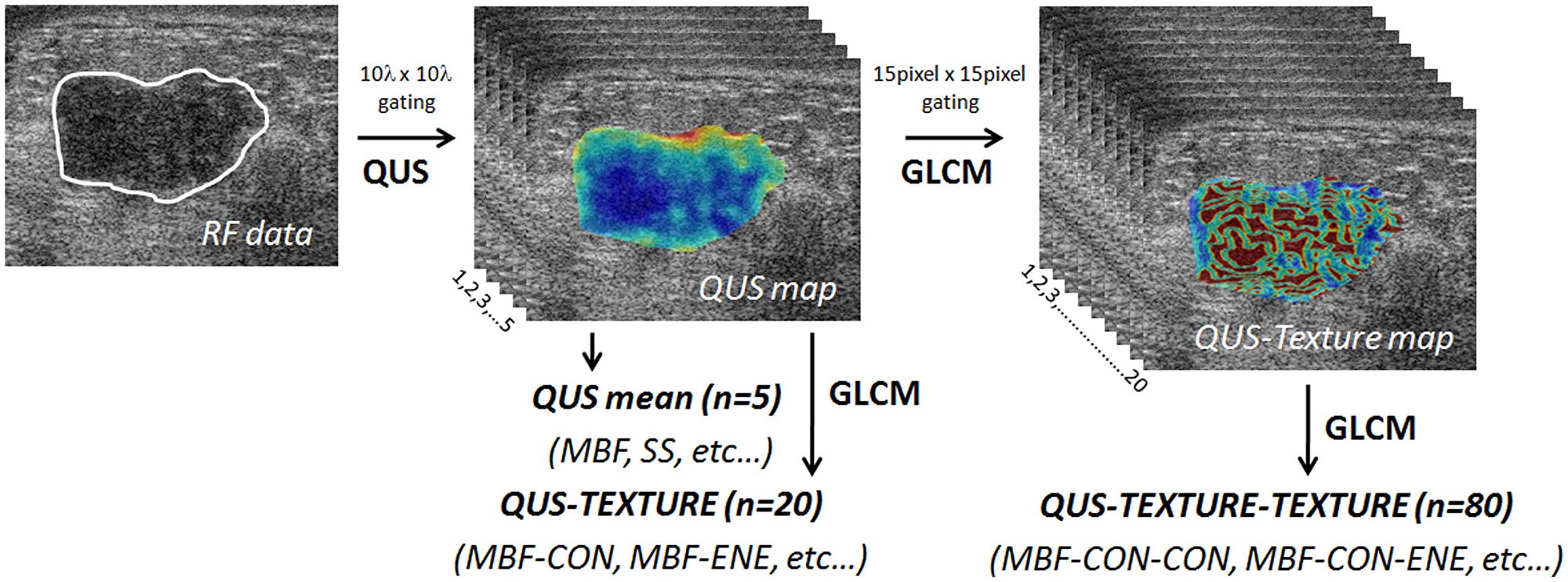 Figure 4: Generation of parametric and texture maps from radiofrequency data.