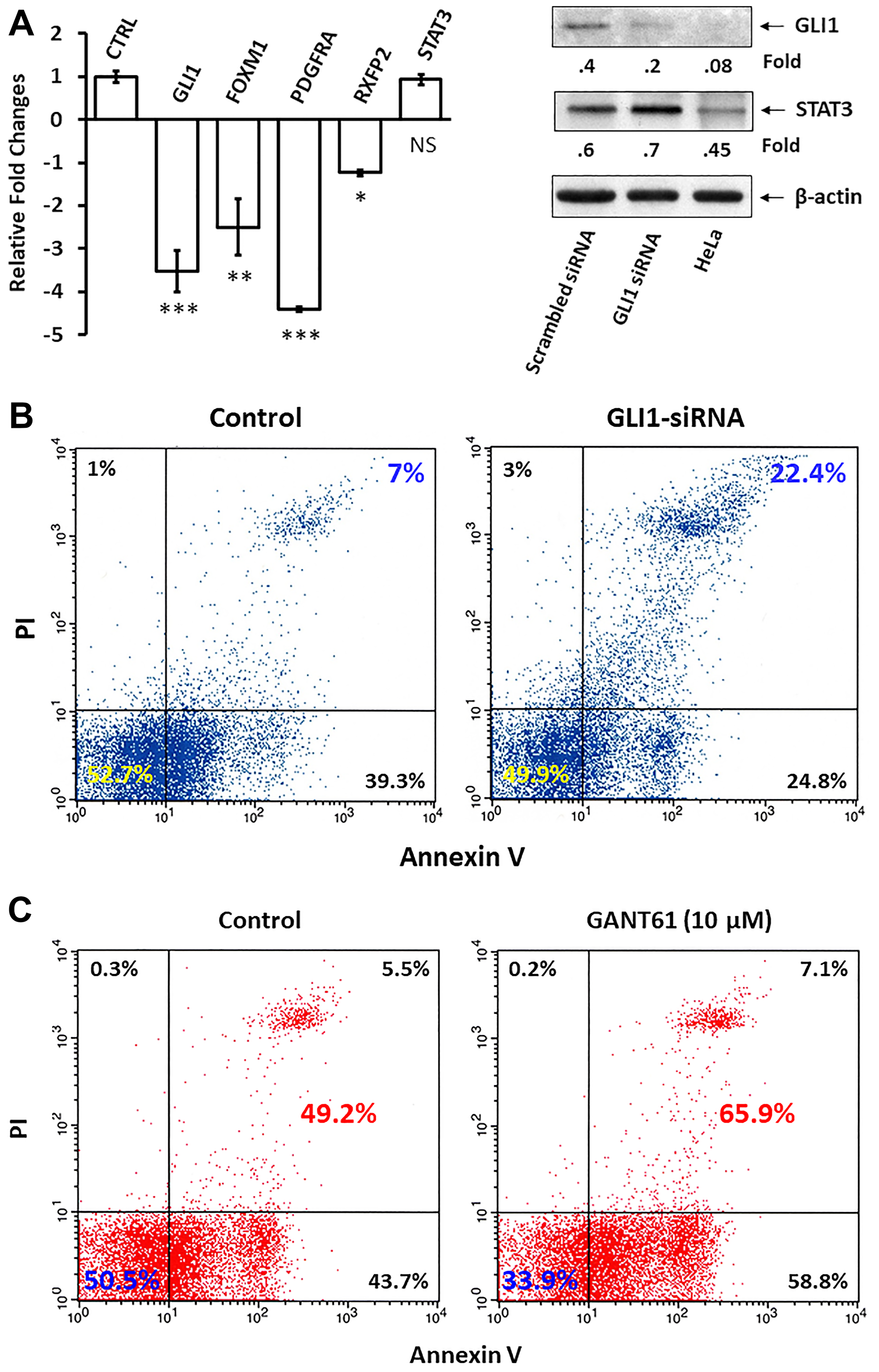 Figure 4: GLI1 protects CLL cells from apoptosis.