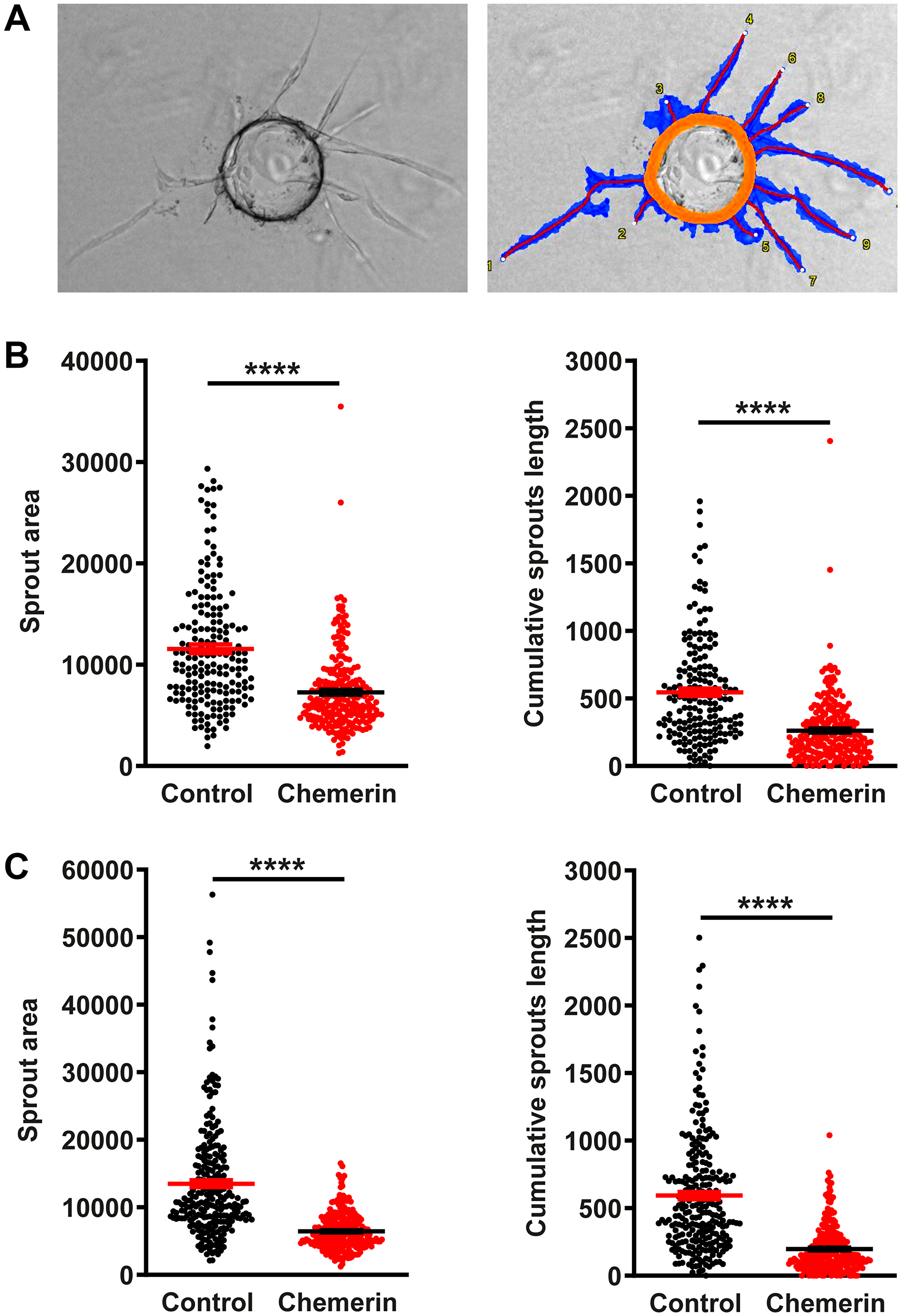 Figure 3: Myo1g over expression is conserved at protein level in acute lymphoblastic leukemia.