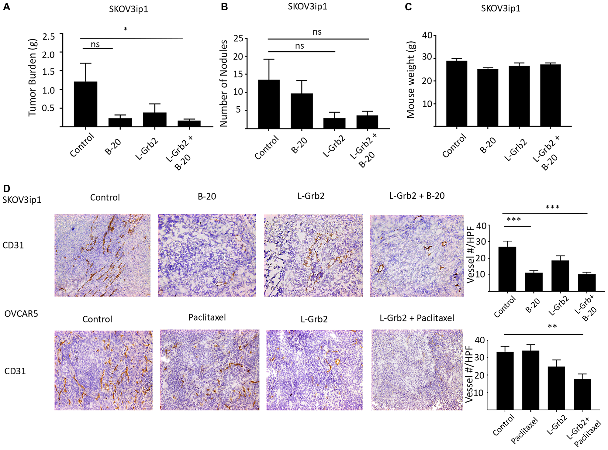 Figure 5:  In vivo effects of treatment with L-Grb2 in combination with anti-angiogenic therapy in an ovarian tumor model.