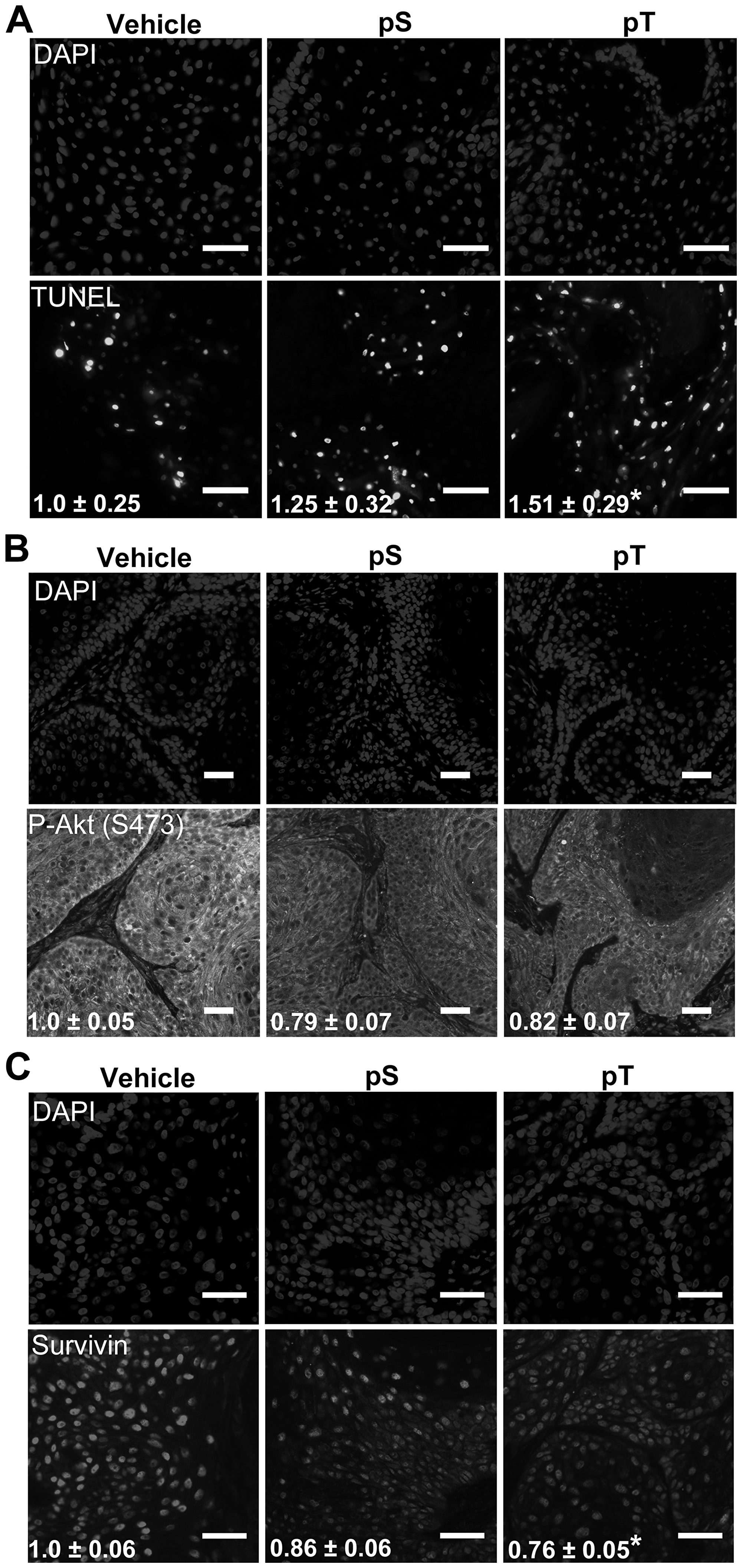 Figure 5: Targeting 14-3-3ε-CDC25A binding increases apoptosis  in vivo