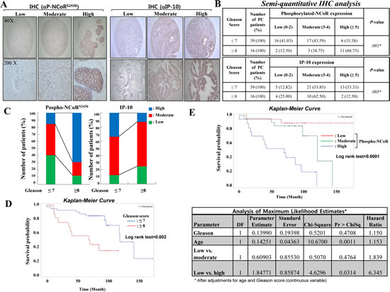 Inverse relationship between IP-10 and NCoR phosphorylation during prostate cancer development.