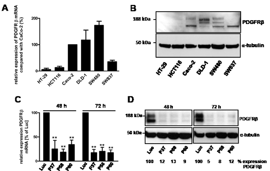 Relative mRNA expression of PDGFR&#x3b2; in CRC cells and siRNA-mediated knockdown of PDGR&#x3b2; in SW480 cells.