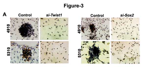Analysis of U251, U87, 4910 and 5310 GSCs treated with Twist1- and Sox2- siRNA.