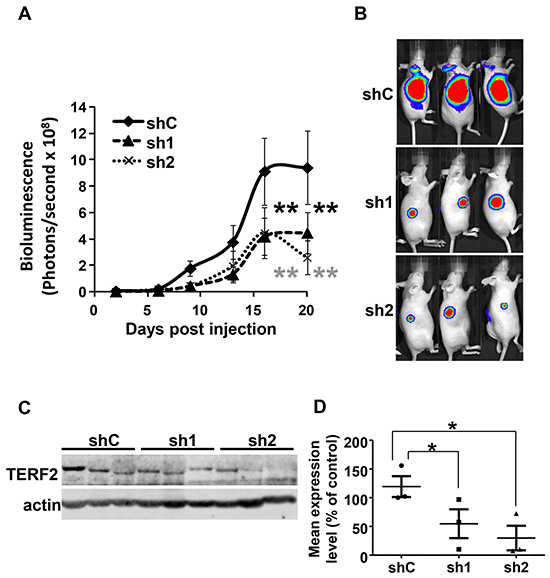 TERF2 down-regulation decreased tumor growth.