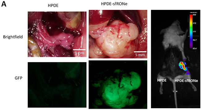 In vivo expression of short form RON is tumorigenic.