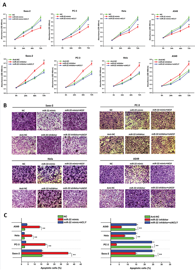 miR-22 attenuates cancer cell proliferation and invasion, but promotes cell apoptosis by targeting ACLY.