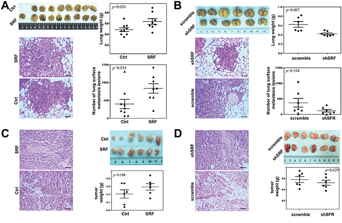 SRF in fibroblasts promotes the pulmonary metastases of gastric cancer cells in NOD-SCID mice.