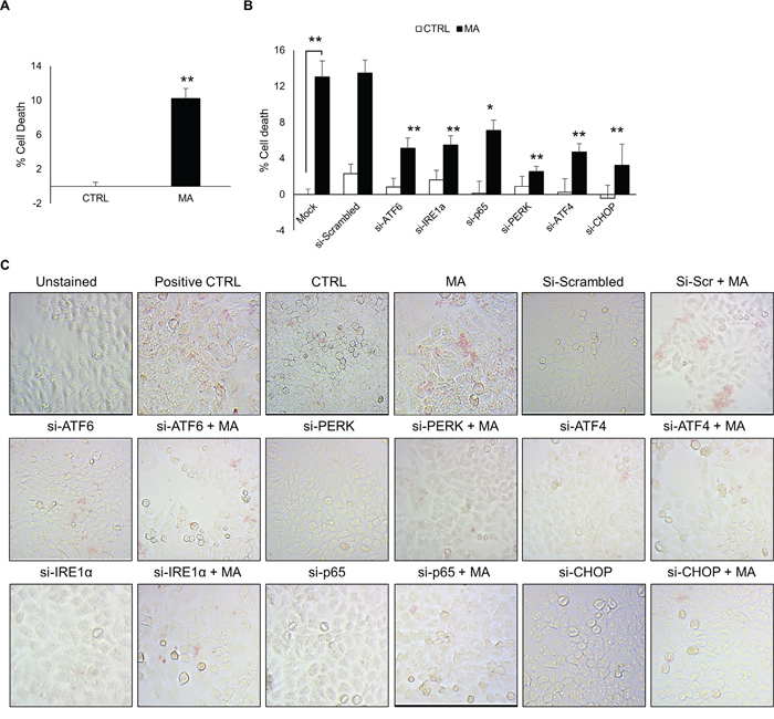MA-mediated ER stress increased cell death in astrocytes.