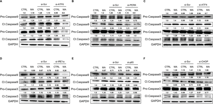 MA-mediated ER stress involved caspase-3 and caspase-9 in astrocyte cell death.