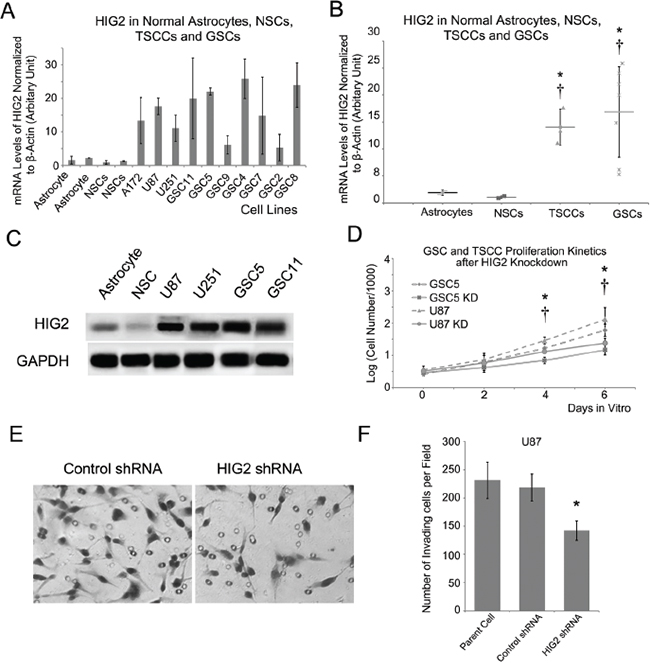 HIG2 is highly expressed in GBM cell lines and promotes GBM cell proliferation and invasion.