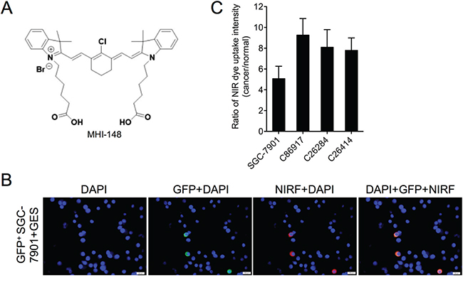 Uptake of MHI-148 dye by human gastric cancer cells.