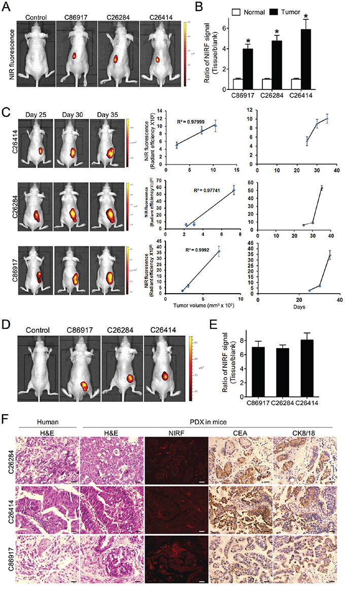 Uptake of NIRF dye and dye-drug conjugate in gastric cancer PDX models.
