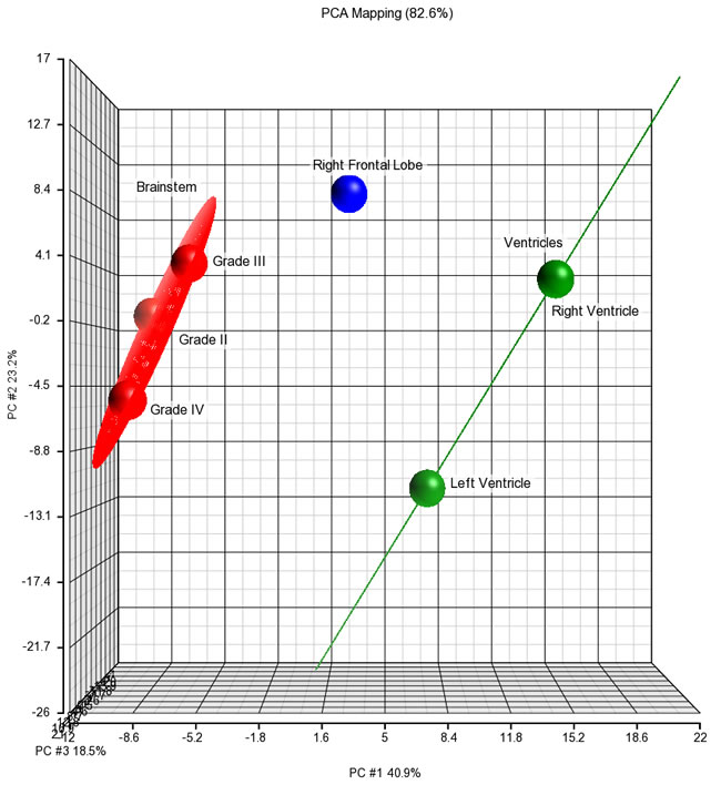 Principal component analysis of differentially expressed mRNA species in brainstem, metastatic right frontal lobe, and metastatic lateral ventricular tumor samples.