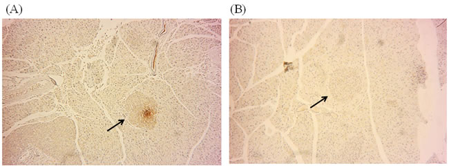 DNMT1 expression was inhibited by ATA in the pancreas.