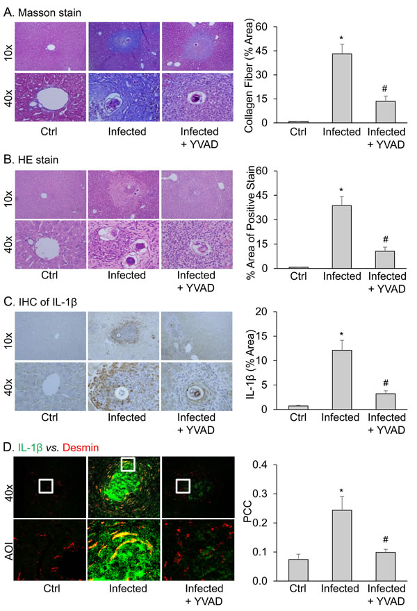 Pathological changes and IL-1&#x3b2; expression in livers from mice infected with