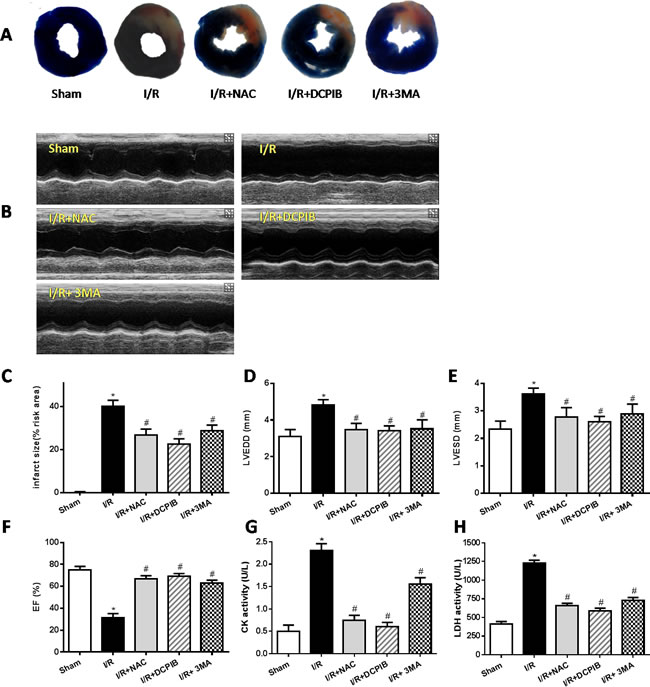 Inhibition of VSOR Cl