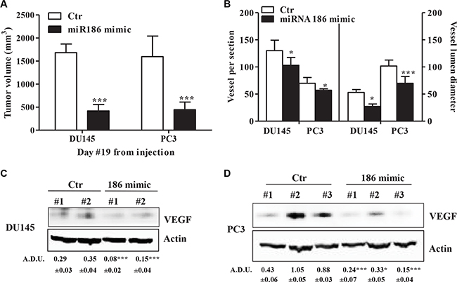 miR-186 controls tumor growth and angiogenesis in vivo.