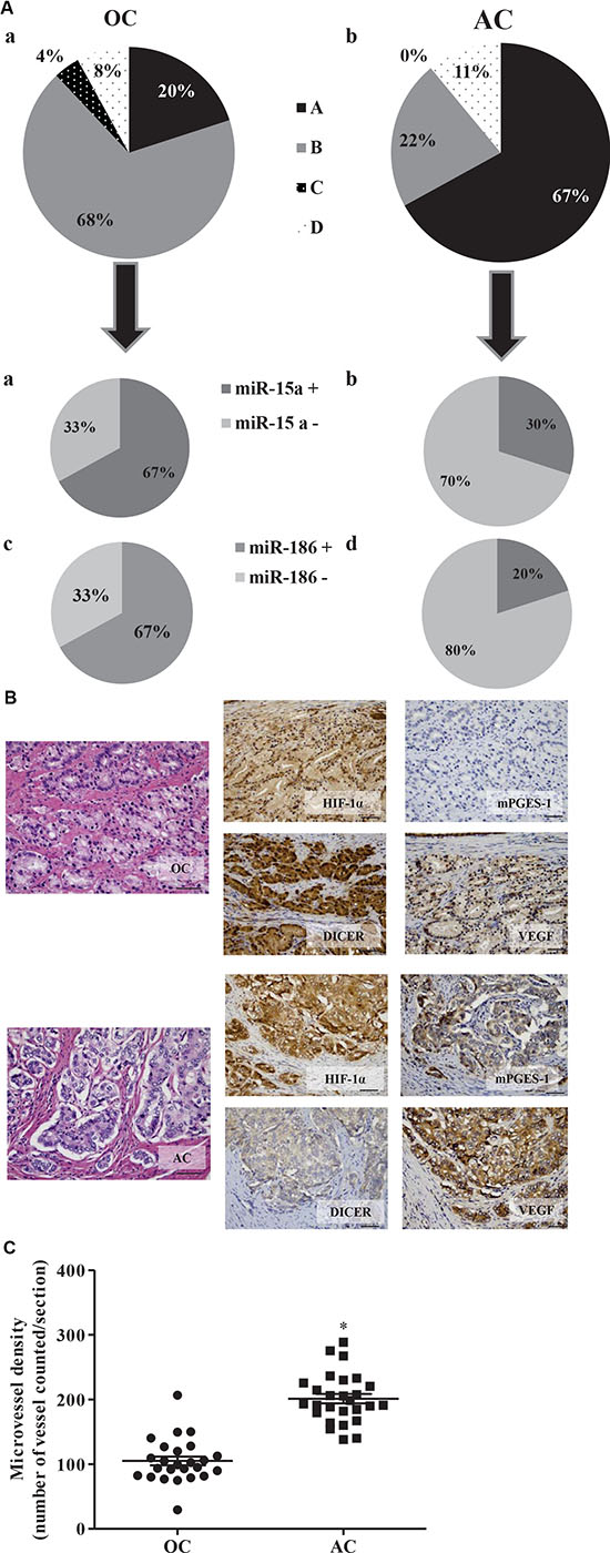 mPGES-1 expression in human prostate cancers is associated with elevated CD31, VEGF, and HIF-1&#x03B1; expression and reduced Dicer, miR-15a and -186 expression.