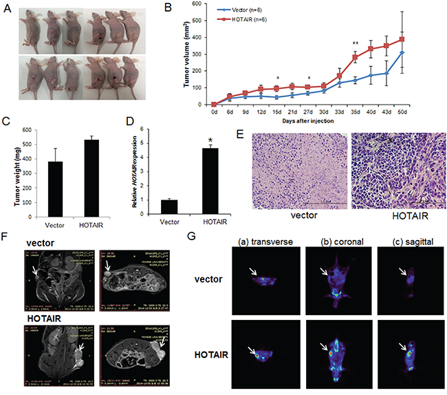 Effect of HOTAIR on tumour growth in vivo.