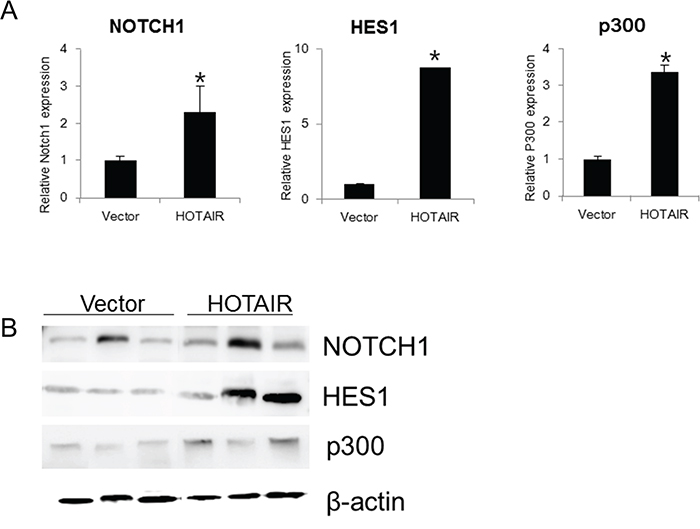HOTAIR overexpression promotes the expression Notch pathway genes in xenografts.