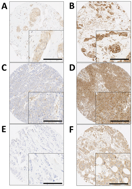 Representative photomicrographs following immunohistochemical staining of A.