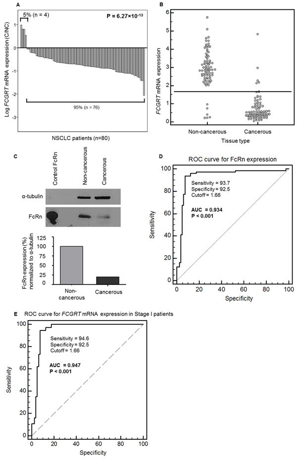 A. Ratios of FCGRT mRNA in cancerous (C) / non-cancerous (NC) in paired tissues from the NSCLC patients (n=80; P = 6.