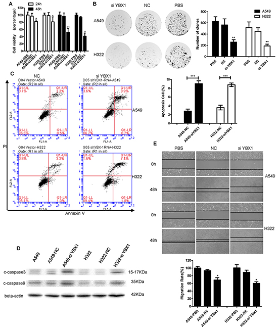 YBX1 knockdown inhibited the growth and migration of lung adenocarcinoma cells and induced apoptosis.