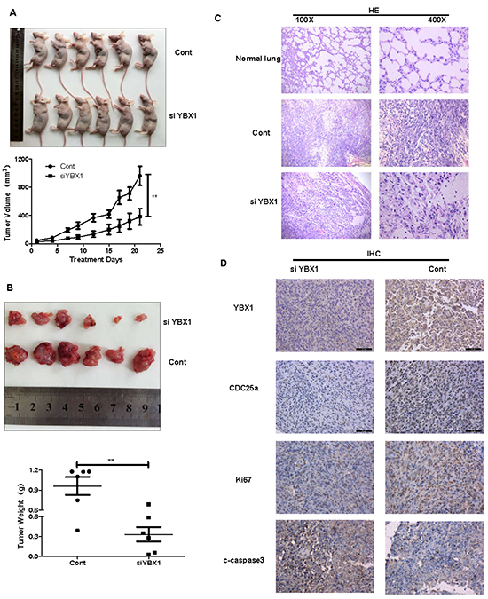 YBX1 knockdown inhibited tumor growth by down-regulating CDC25a expression.
