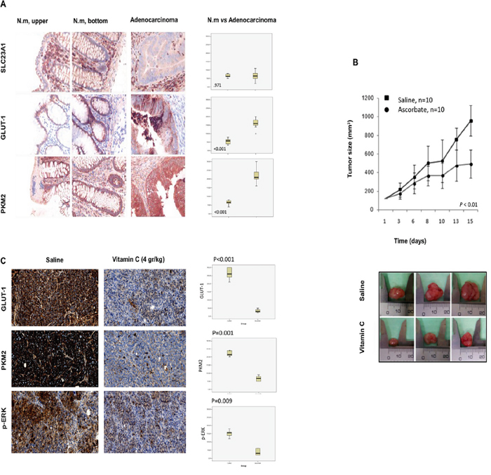 Vitamin C inhibits tumor growth in SW480 xenografts generated in athymic nude mice Foxn1nu though downregulation of GLUT-1, p-ERK and PKM2.