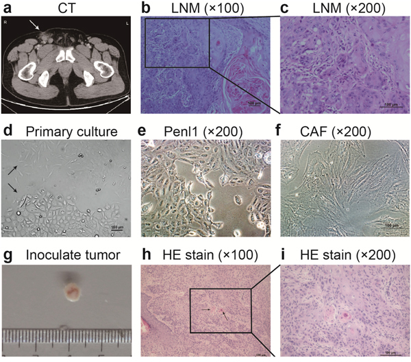 Morphology of LNM, Penl1 cells and their inoculated tumors in SCID mice.