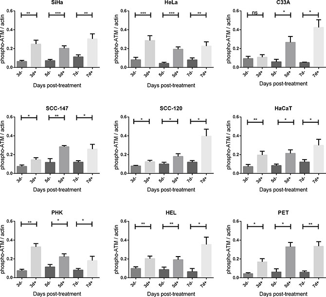 Phospho-ATM protein expression after CDV exposure.