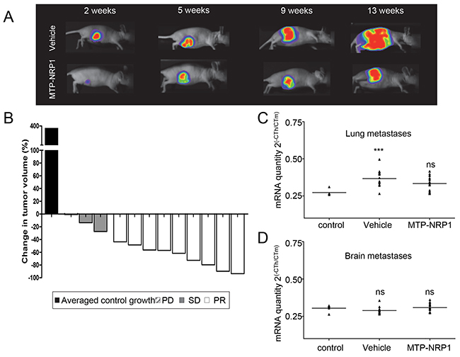 MTP-NRP1 inhibits primary breast tumor growth in vivo.