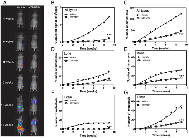 MTP-NRP1 exhibits anti-metastatic properties.