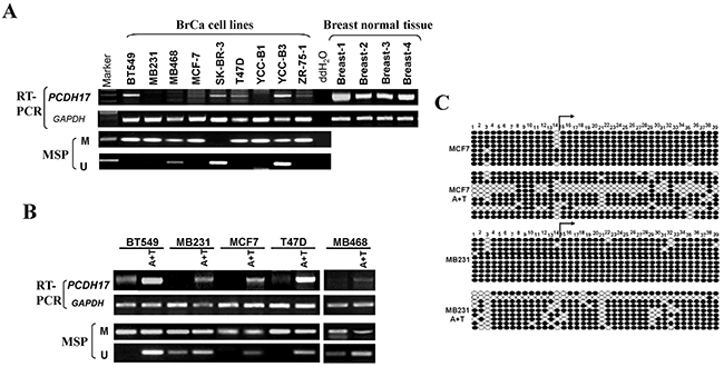Expression and methylation of PCDH17 in breast tumor cells.