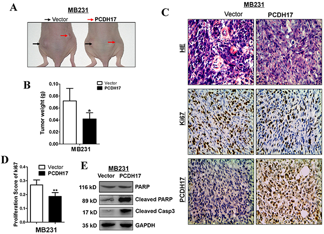 PCDH17 inhibited breast cancer tumorigenicity in vivo.