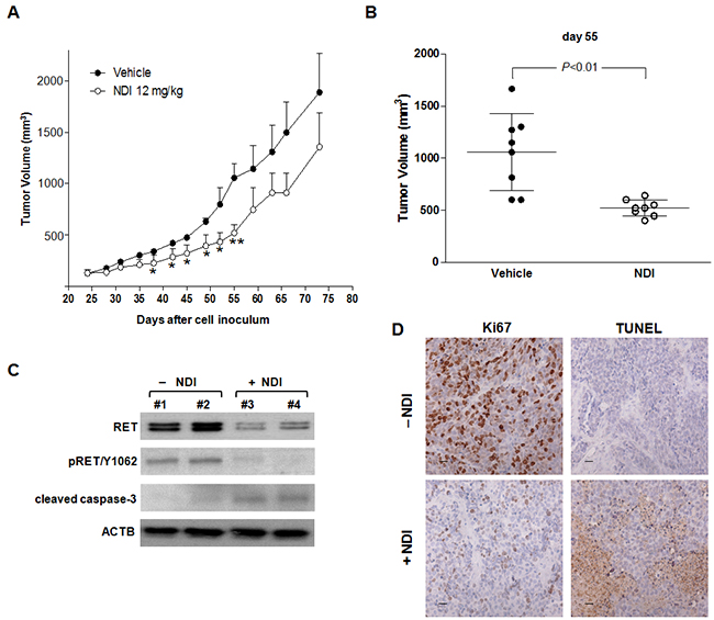The NDI derivative inhibits MTC tumor growth in vivo.