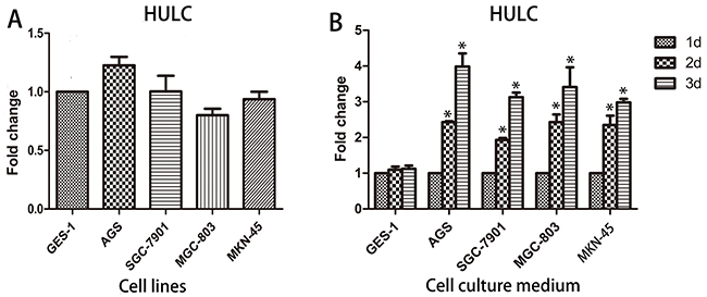 Origin of circulating HULC.