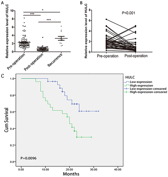 RT-qPCR and Kaplan-Meier analysis for predicting HULC as a GC prognosis biomarker.