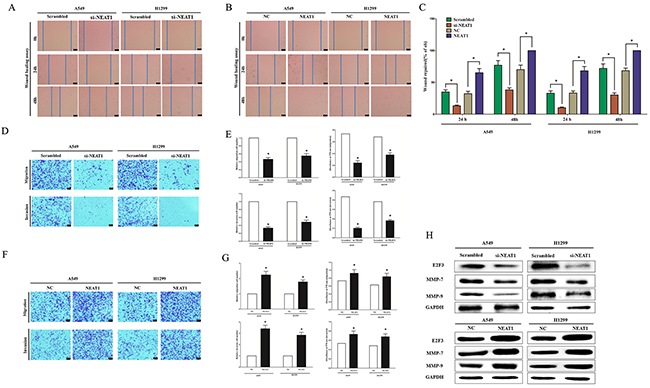 NEAT1 promotes NSCLC cell migration and invasion in vitro.